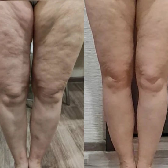 So much improvement in only 6 weeks!